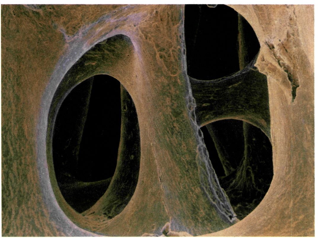 εικ. 7.3 Μυελοκυψέλες