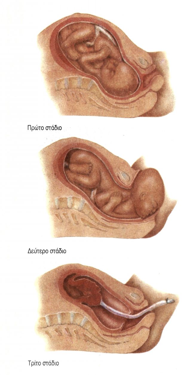 εικ. 12.12 Τα στάδια του τοκετού