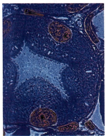 εικ. 6.8 Το πρώτο σπειροειδές τμήμα του νεφρώνα σε τομή