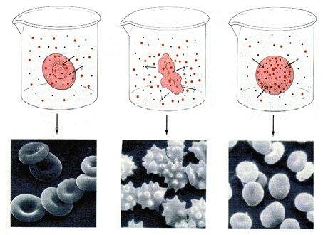 ΣΧΗΜΑ 1.18 Ερυθρά αιμοσφαίρια σε διάλυμα α. ισοτονικό β. υπερτονικό και γ. υποτονικό ως προς το ενδοκυττάριο υγρό.