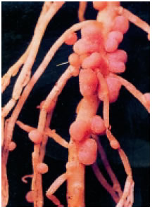 Εικόνα 2.15: Φυμάτια αζωτοδεσμευτικών βακτηρίων στις ρίζες των ψυχανθών