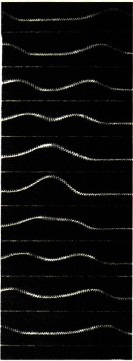 Εικ. 2.3 Φωτογραφίες από δύο κυματικούς παλμούς που διαδίδονται κατά μήκος ενός ελατηρίου